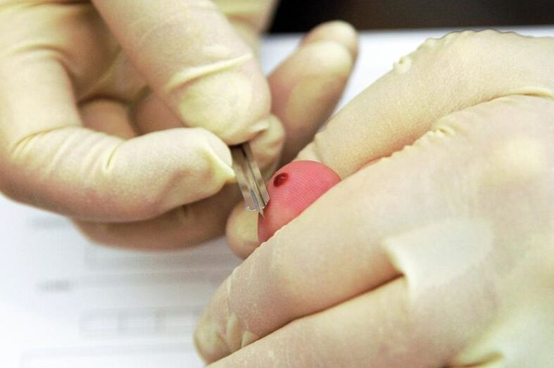 A blood fence from the finger